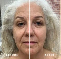 Quantiva™ Lymphatic Face Brush